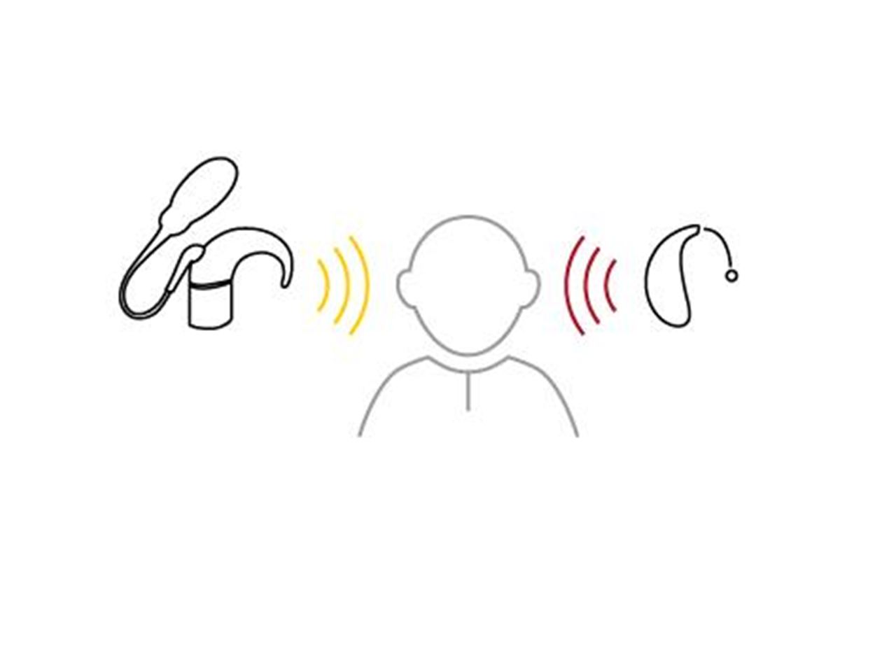 Ritning av ReSounds bimodala lösning med cochleaimplantat.
